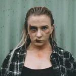 A female victim of domestic violence with a black eye and facial bruising