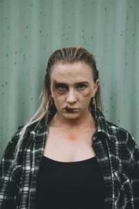 A female victim of domestic violence with a black eye and facial bruising