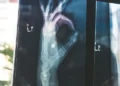 an x-ray image of a hand doing the OK sign