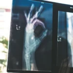 an x-ray image of a hand doing the OK sign