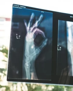 an x-ray image of a hand doing the OK sign