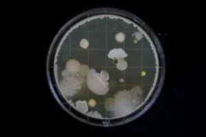 A petri dish